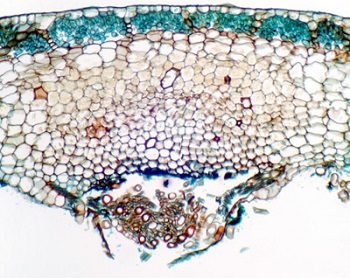 Preparaciones microscpicas - Histologa vegetal - Musgos y hepticas