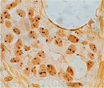 AGNOR 48 TEST