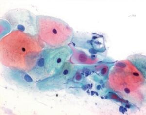 Solucin colorante y kits para citologa, MERCK