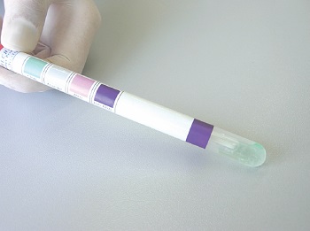 Hisopos p/ deteccin de residuos orgnicos en superficies CLEAN TEST, LIOFILCHEM®