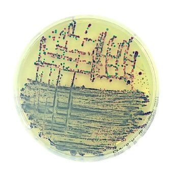 Placas preparadas d=90 mm c/ medios de cultivo cromognicos deshidratados, LIOFILCHEM®