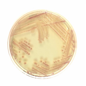 Chromatic Super CAZ/AVI, placas preparadas d=90mm c/ medio cromognico p/ deteccin de bacterias gramnegativas resistentes a ceftazidima-avibactam, 20 Unid, LIOFILCHEM®