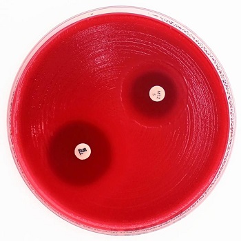 Fastidious Anaerobe Agar (FAA), placas d=90 mm, p/ cultivo y test de susceptibilidad antimicrobiana de bacterias anaerobias, 2 meses de vida til, recomendacin EUCAST, 20 Unid, LIOFILCHEM®