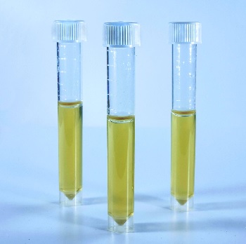 D008 SRB TUBE Test p/ la determinacin de las bacterias reductoras de sulfatos, 10 unid., LOVIBOND