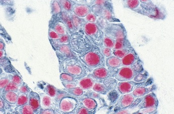 VECTASTAIN Elite ABC-HRP, peroxidasa (estndar), 1 kit, VECTOR LABS®